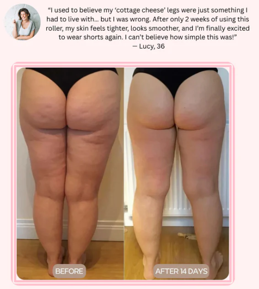 CACHÈE™ Cellulite Roller