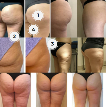 <strong>Visible Results You Can See</strong>